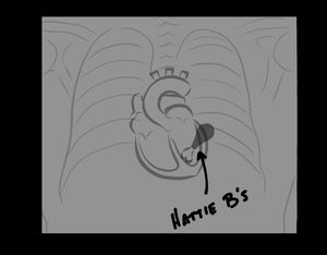 Hot chicken, left ventricle